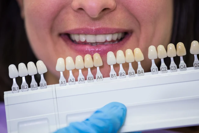 Est tica dental lentes e facetas