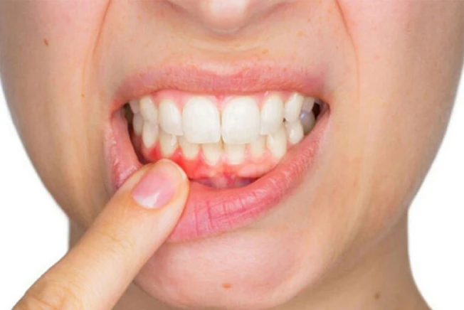Periodontia